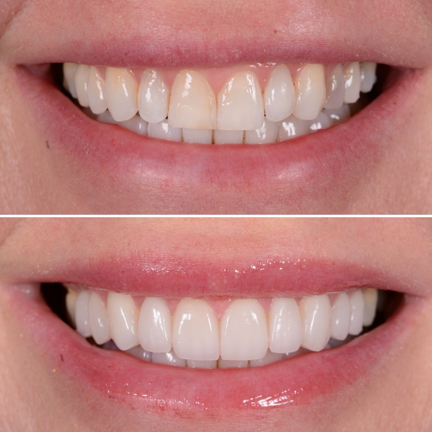 Winner small image - Bespoke Smile